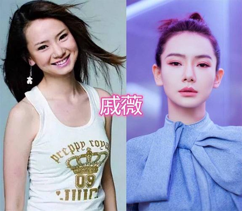 脸崩到没法看！娱乐圈那些动刀翻车惨案大赏