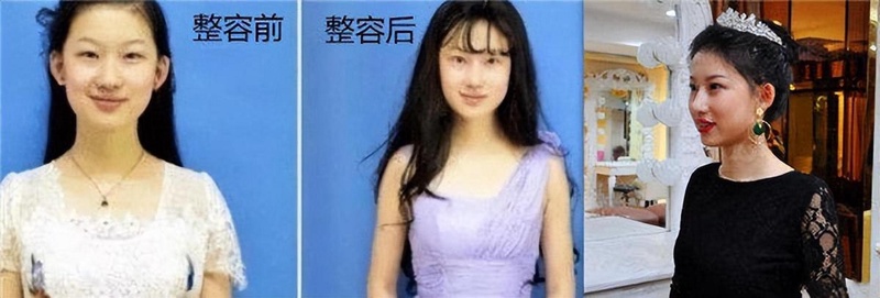 脸崩到没法看！娱乐圈那些动刀翻车惨案大赏
