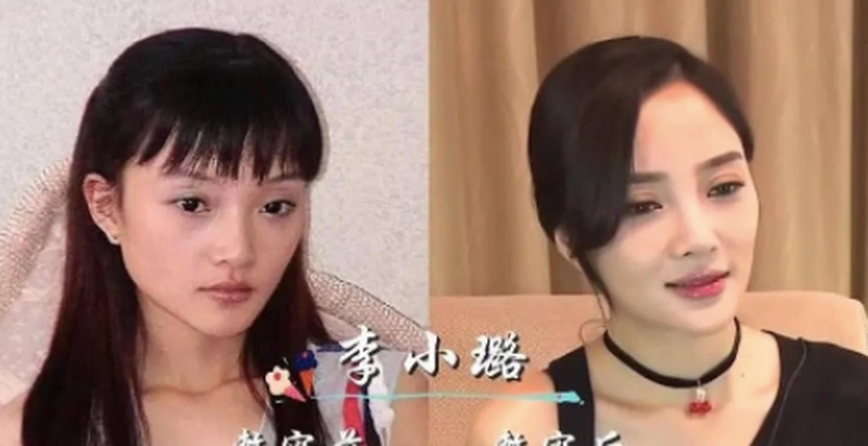 脸崩到没法看！娱乐圈那些动刀翻车惨案大赏